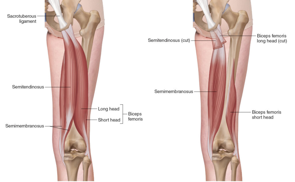 Hamstring | Adam Loiacono