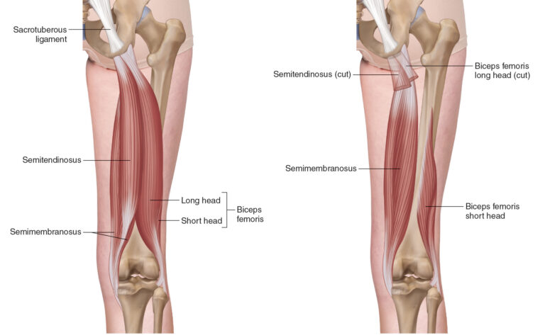 Complete Guide to Hamstring Strains: Recovery, Timelines, and Rehab ...
