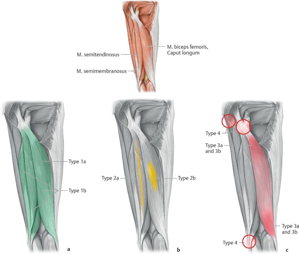 Muscle Strains munich | Adam Loiacono