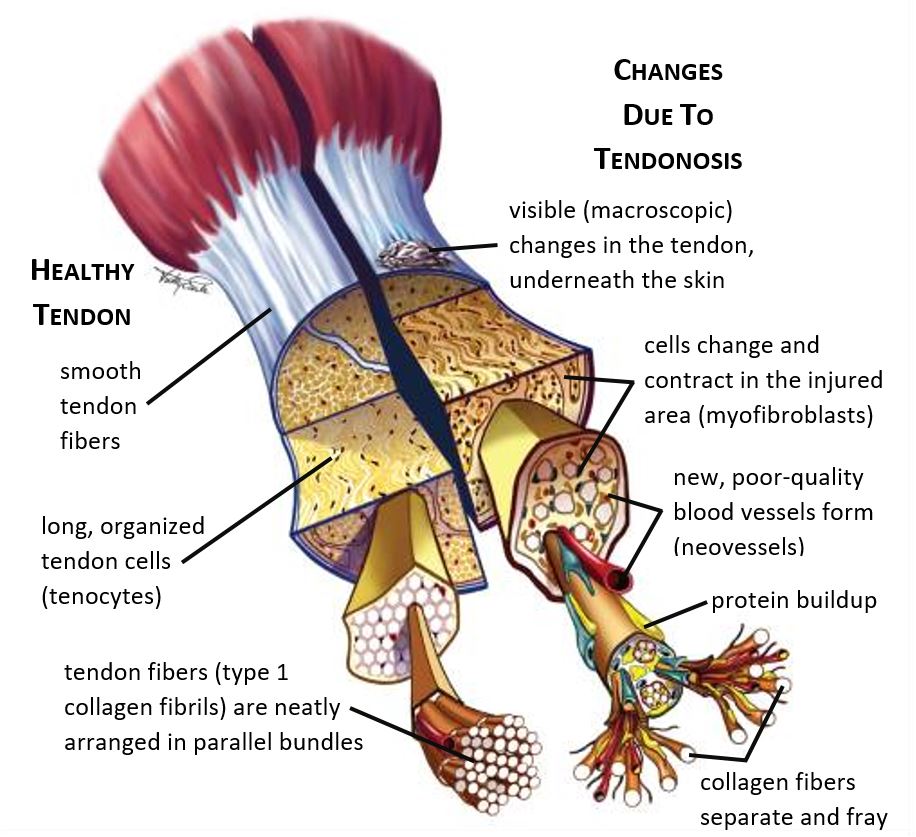 Tendon | Adam Loiacono