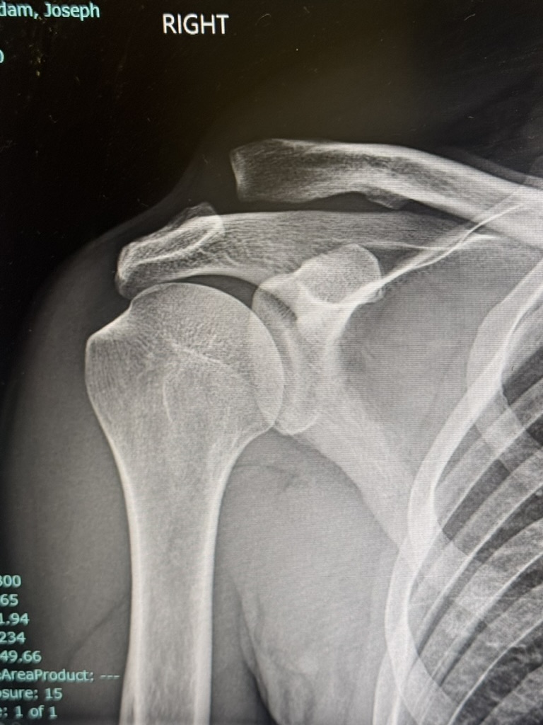 XR ac separation | Adam Loiacono
