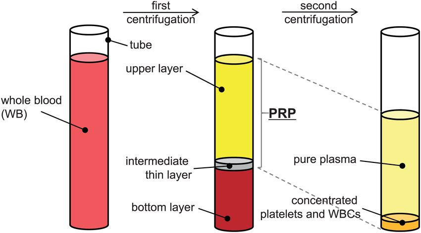 PRP process | Adam Loiacono