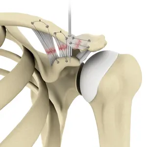 ac-joint-repairjpg | Adam Loiacono