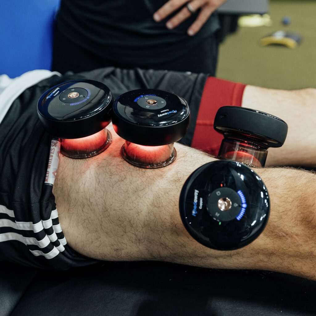 Cupping | Adam Loiacono